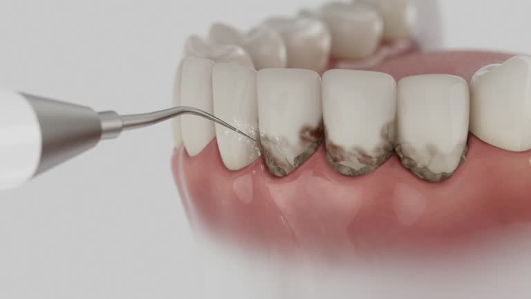 Reliable Wisdom Tooth Removal contractor in Van Buren County County, TN by Dentist Open Now